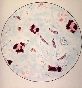 microscopic-view-of-a-malaria-parasite-everett